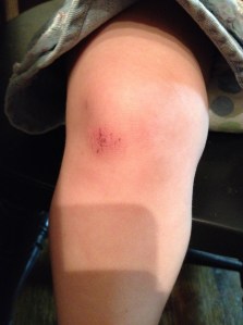 I think this is what a child's knee should look like in the summer. Fun!